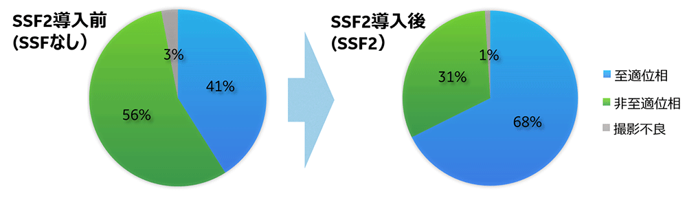 ポケット臨床脳波 |本 | 通販 | Amazon